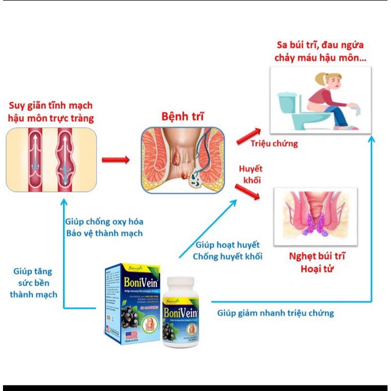 Bonivein hỗ trợ dãn tĩnh mạch hộp 30v nhập khẩu chính hãng