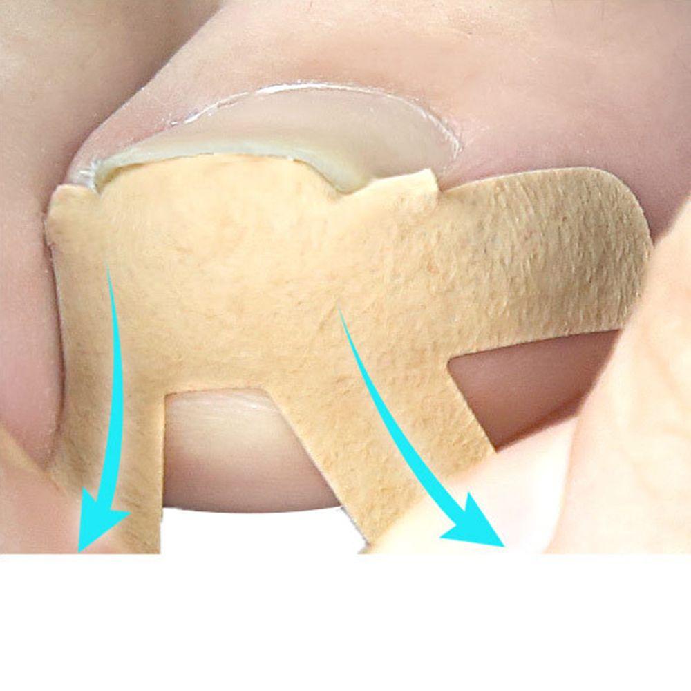 Miếng Dán Sửa Chữa Móng Chân Chống Nước Tiện Dụng