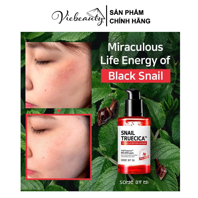 Tinh Chất Ốc Sên Serum Some By Mi Cải Thiện Sẹo Mụn, Thâm, Rổ Hiệu Quả Snail Truecica Miracle Serum 50ml - Khongcoson | BigBuy360 - bigbuy360.vn