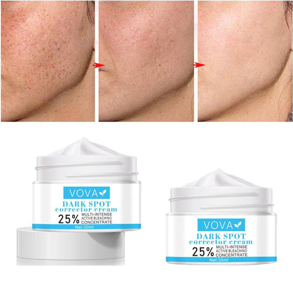 Kem Làm Trắng Da Mặt Loại Bỏ Melanin Dưỡng Ẩm Hiệu Quả