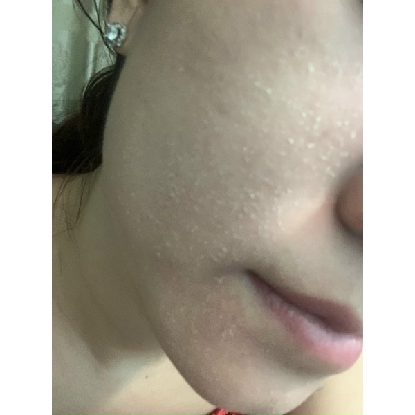 Serum tái tạo đặc PHIÊN BẢN MỚI dùng da MỤN-THÂM_NÁM_TÀN NHANG HANDMADE