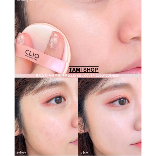 Set Phấn Nước Clio Kill Cover Glow Fitting Cushion