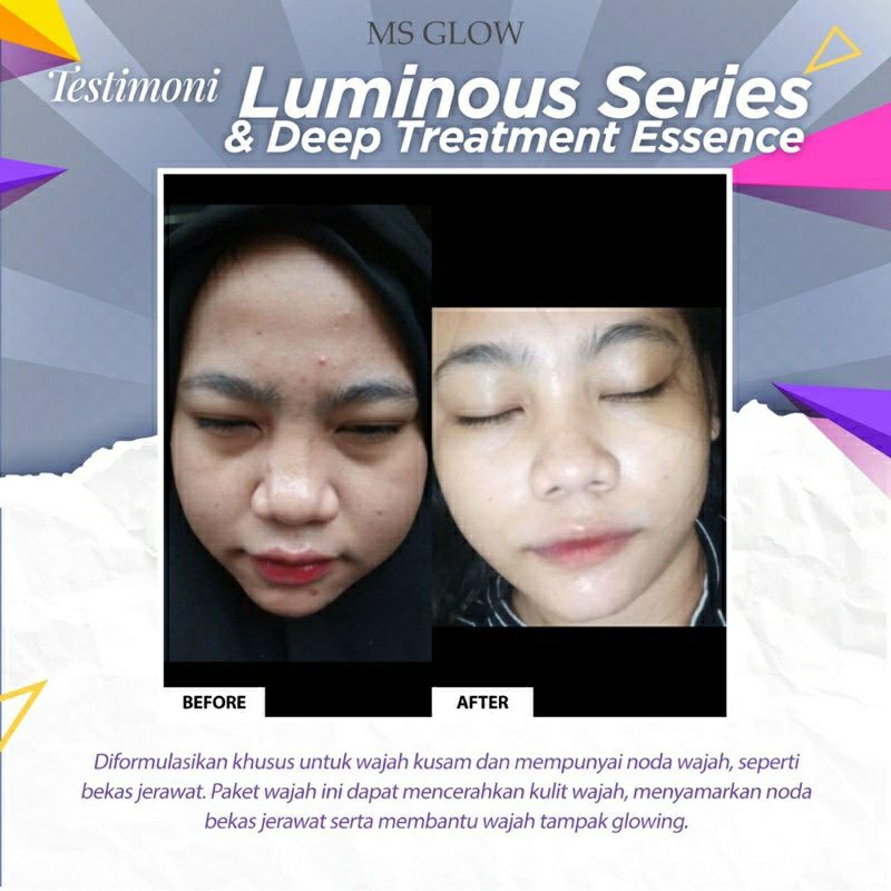 Mặt nạ Ms GLOW ☑ ☑️ Nguyên bản | BigBuy360 - bigbuy360.vn