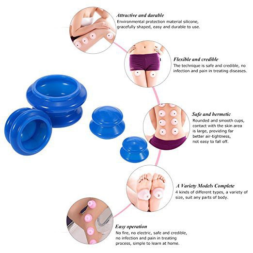 Bộ 4 cốc giác hơi bằng silicon tiện lợi