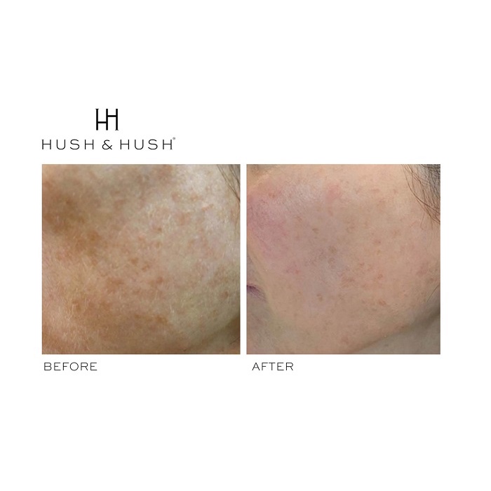 Viên uống trắng da, mờ nám Image Skincare Hush &amp; Hush SkinCapsule Brighten+ 60 viên