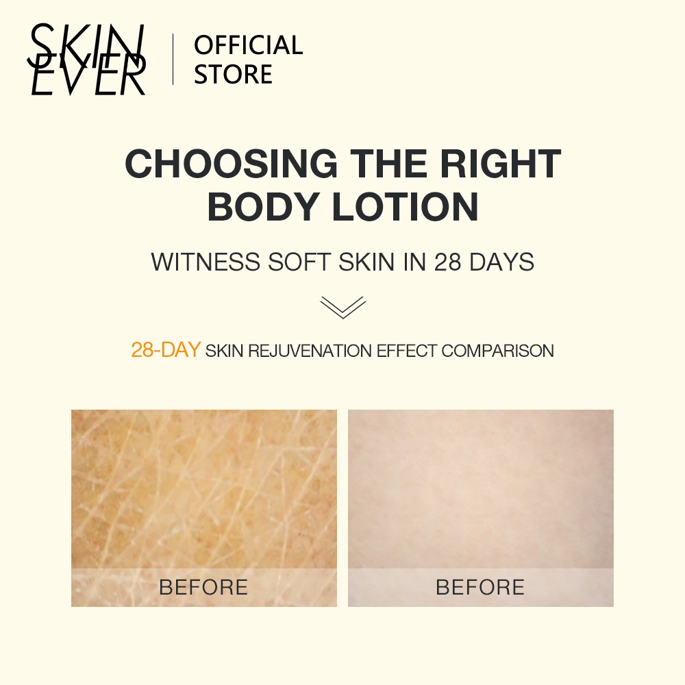 Kem dưỡng thể SKIN EVER chiết xuất dầu dừa 150g