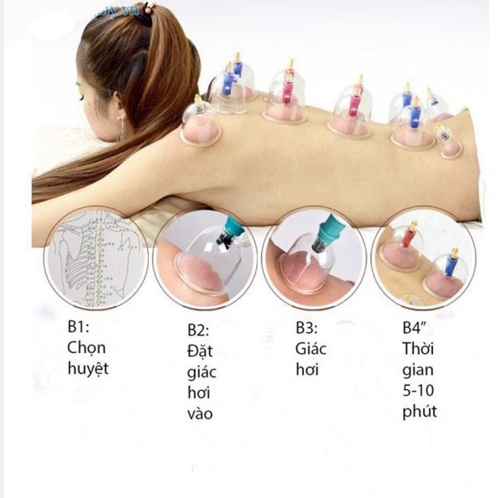 Bộ Giác Hơi 24 Ống Chân Không Cao Cấp Máy Giác Hơi Giá Rẻ Không Dùng Lửa  24 Phụ Kiện