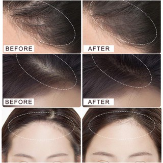 Phấn Che Khuyết Điểm Vùng Chân Tóc Maycheer