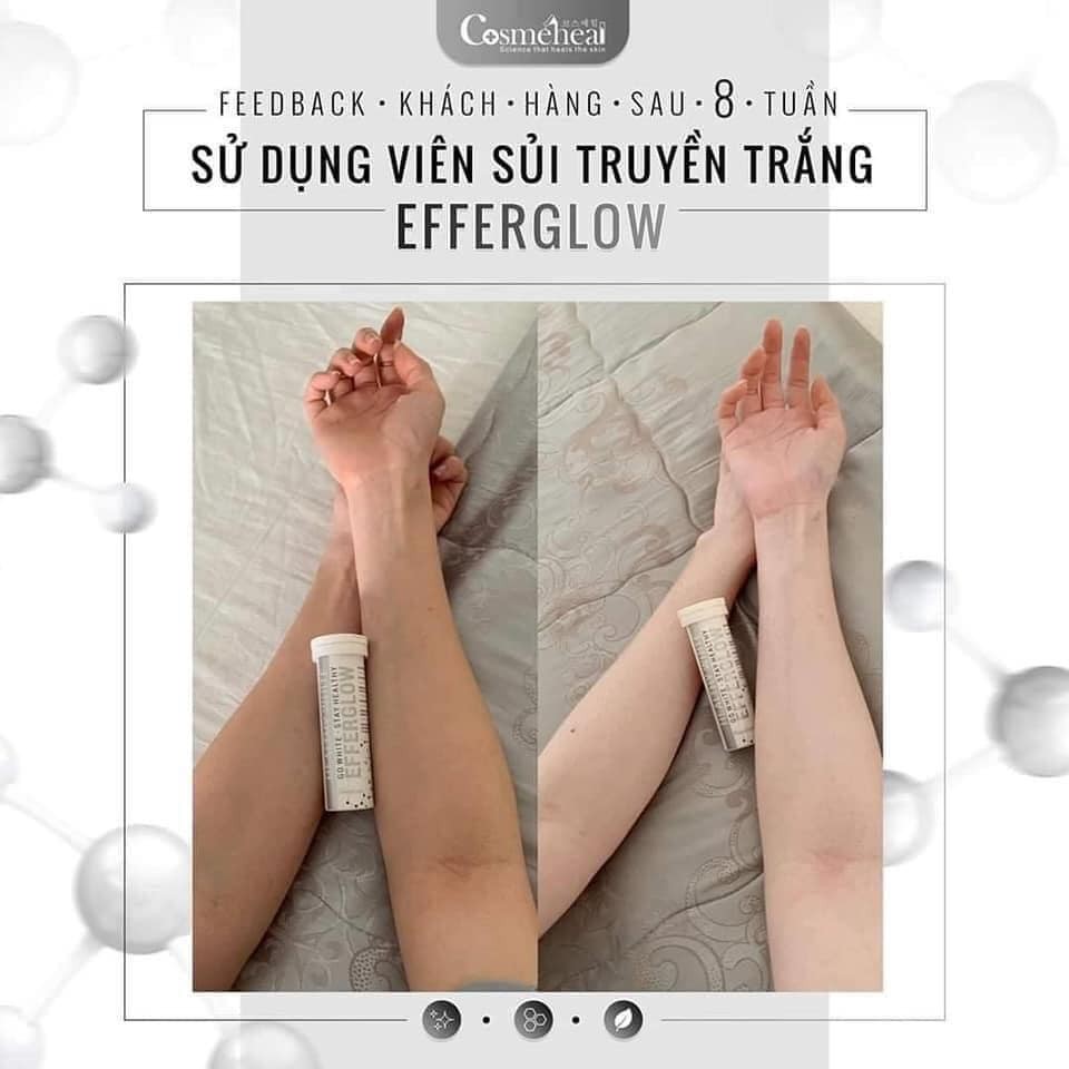 TRUYỀN TRẮNG DẠNG SỦI EFFERGLOW COSMEHEAL