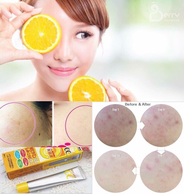 SERUM VITAMIN C ROHTO MELANO CC HỖ TRỢ GIẢM THÂM MỤN CC MELANO