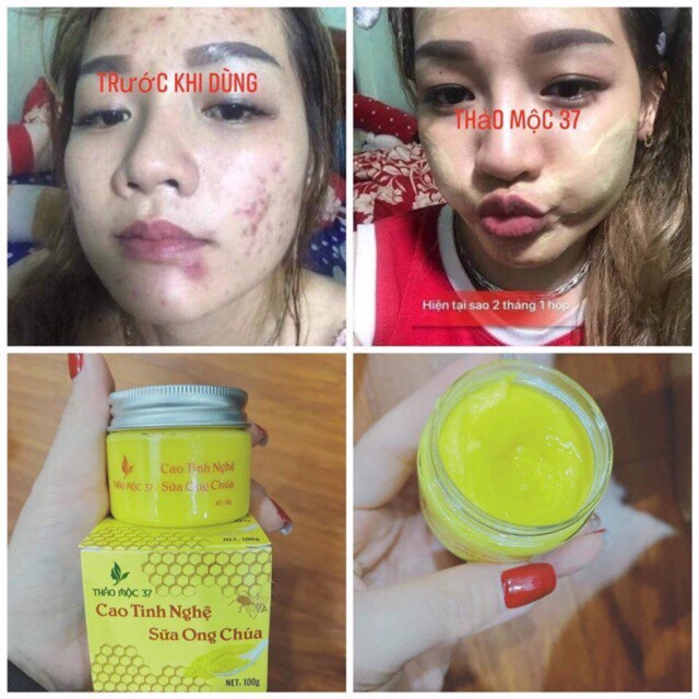 Hũ mặt nạ cao tinh nghệ sữa ong chúa 37 của Thảo Mộc 37 . | BigBuy360 - bigbuy360.vn