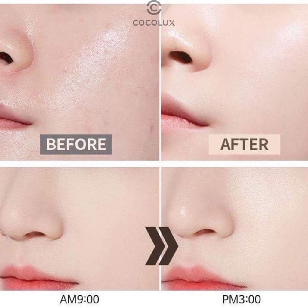 Kem Nâng Tông Trắng Da Sur.medic-[COCOLUX]