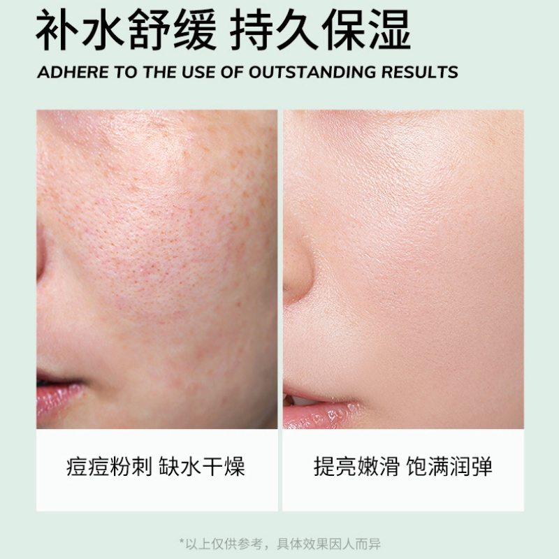 [Hàng mới về] Gel lô hội HOUMAI dưỡng ẩm thu nhỏ lỗ chân lông chăm sóc da