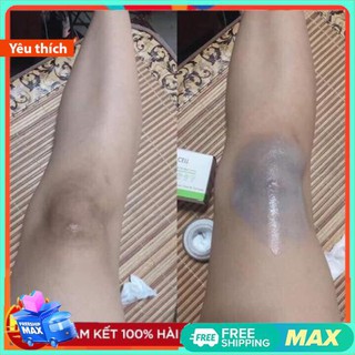 Kem mờ thâm OL-Cell Hàn Quốc