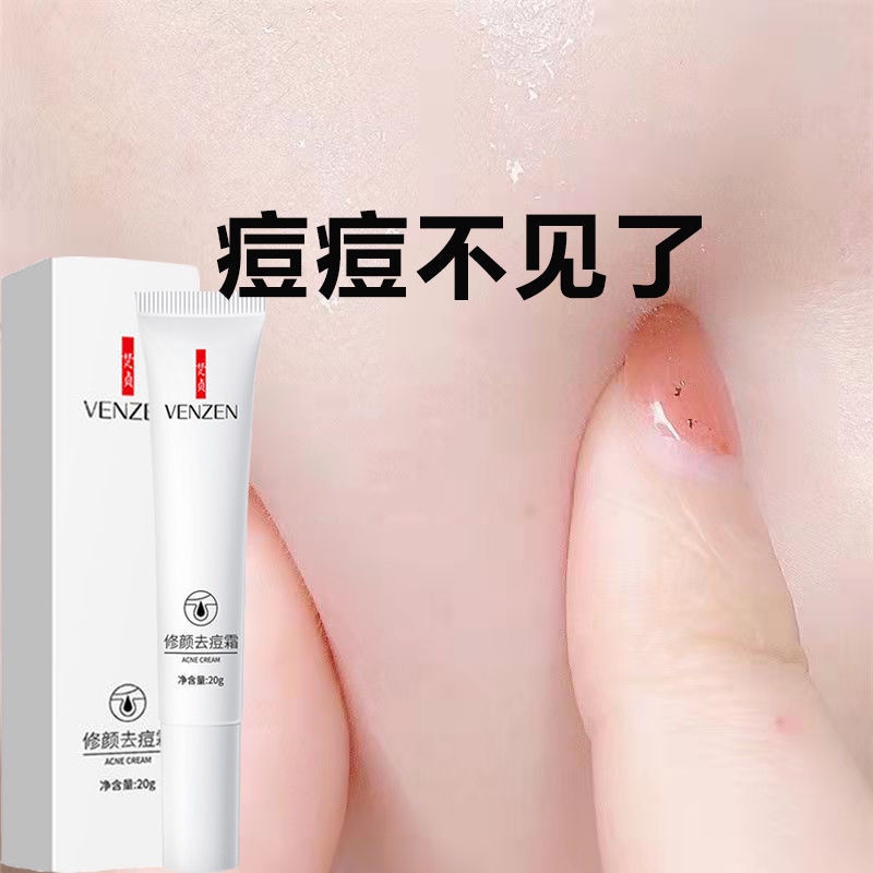 Kem Hỗ Trợ Giảm Mụn Trứng Cá Làm Mờ Vết Thâm Mụn Phục Hồi Miệng Trẻ Hóa Làn Da Cho Học Sinh Manshanzc.My11.27 | BigBuy360 - bigbuy360.vn
