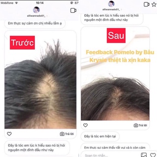 PRO POMELO Hair Mist - Xịt Bưởi Kích Mọc Tóc ( Handmade )