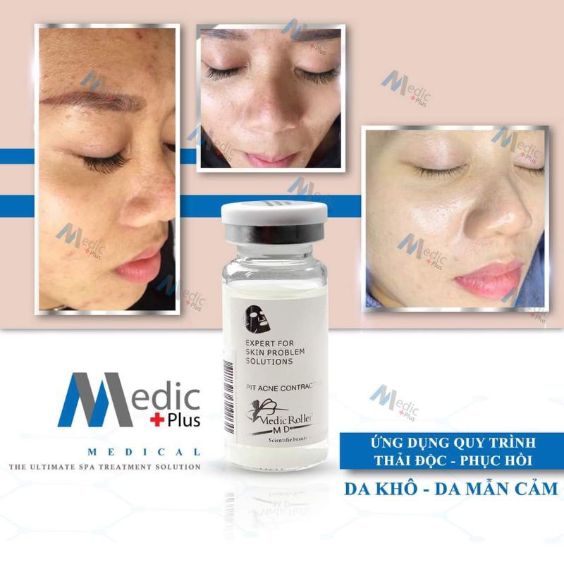 Serum mụn Medic Roller_ Tế bào gốc mụn Medic Roller | BigBuy360 - bigbuy360.vn