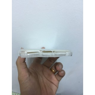 ốp dẻo trong suốt xiaomi redmi 4X