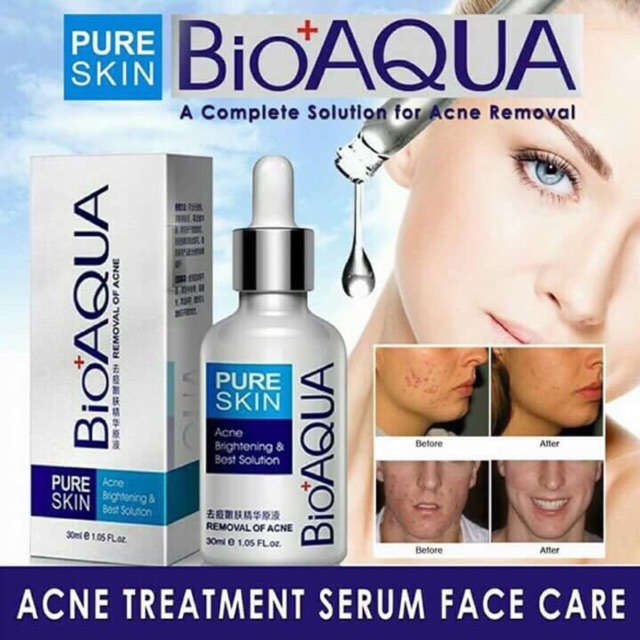 SERUM dưỡng da mụn BIOAQUA 30ml