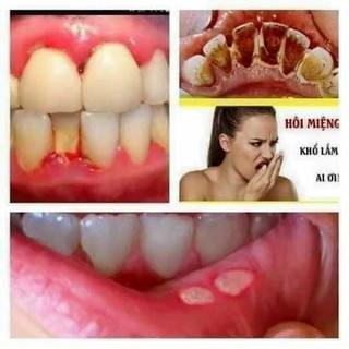 Thảo mộc Răng Miệng Trần Kim Huyền