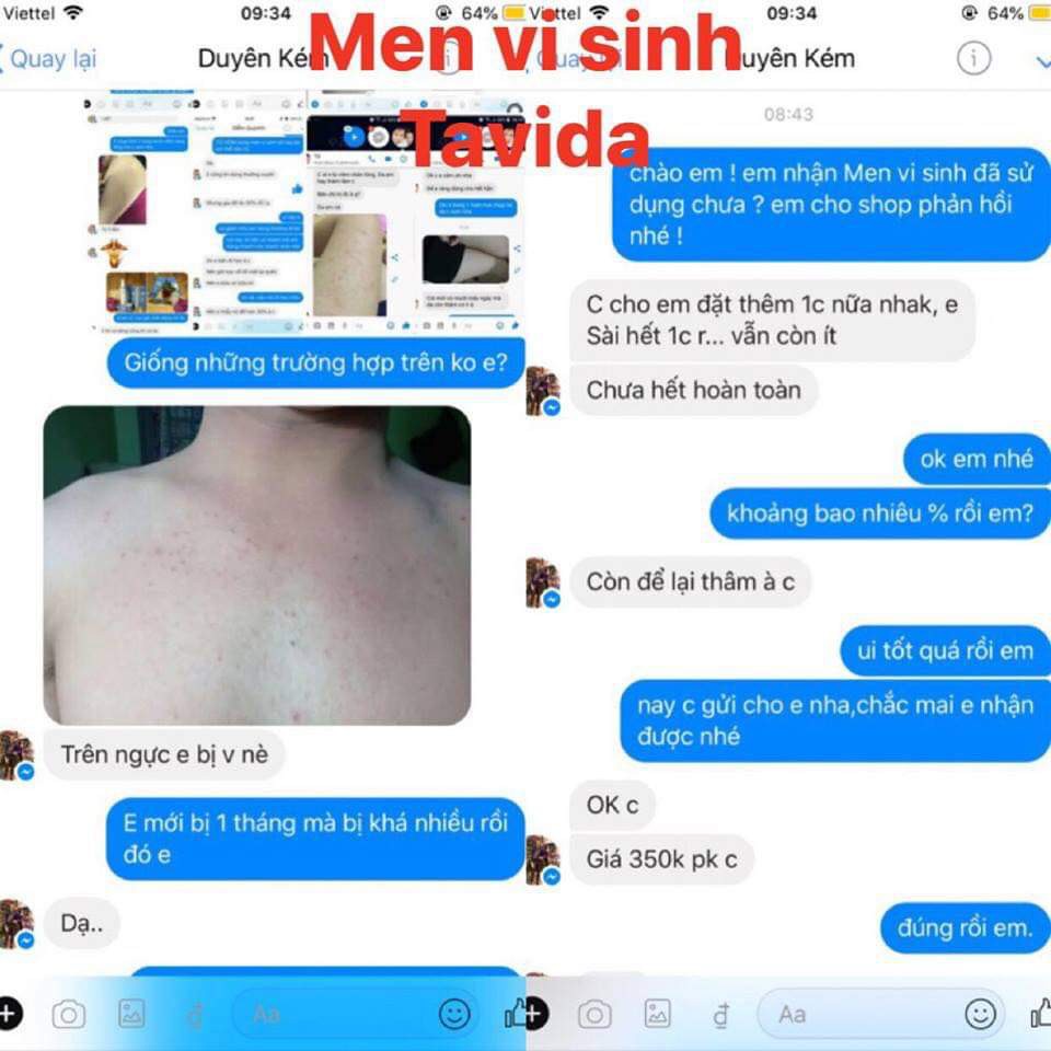 MEN VI SINH TAVIDA DÀNH CHO DA VIÊM NANG LÔNG, MỤN LƯNG NGỰC