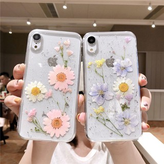 ỐP IPHONE - Ốp lưng Hoa thật ép khô x/xs/xs max/11/11pro max - GIAO HÀNG TRONG 3-5 ngày