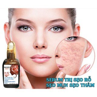 Set Serum Kem Xóa Sẹo Rỗ