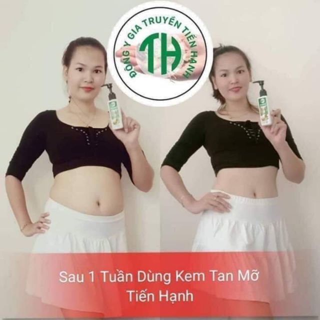 Kem tan mỡ bụng sau sinh Tiến Hạnh_tặng đai nịt bụng và thước đo