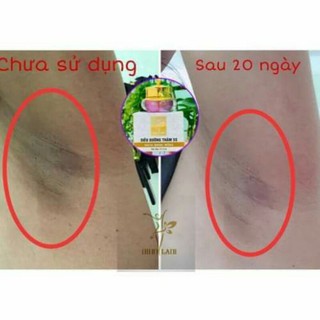 [CHÍNH HÃNG] SIÊU DƯỠNG THÂM 5S BIHOLADI