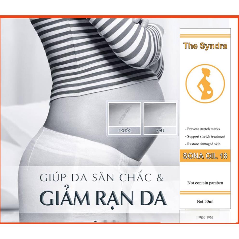 Dẩu rạn da chống rạn da cho bà bầu | BigBuy360 - bigbuy360.vn