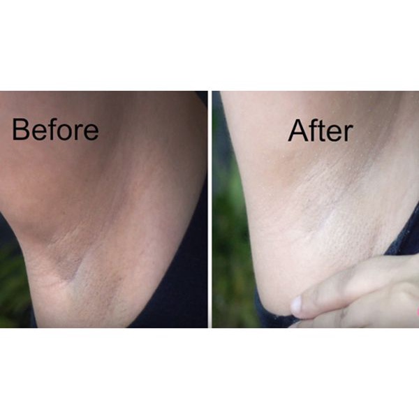 [Nội địa Nhật] Xà phòng giảm thâm nách Pelican | BigBuy360 - bigbuy360.vn