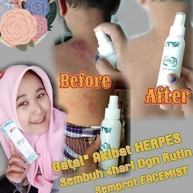 Cổ phiếu trị giá	1 chai tinh chất vàng 100% nguyên bản từ MSI | BigBuy360 - bigbuy360.vn