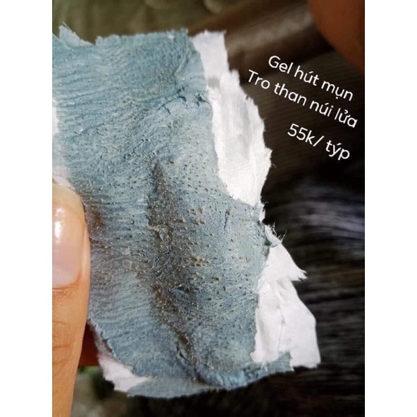 gel hút mụn Hải Âu việt | BigBuy360 - bigbuy360.vn