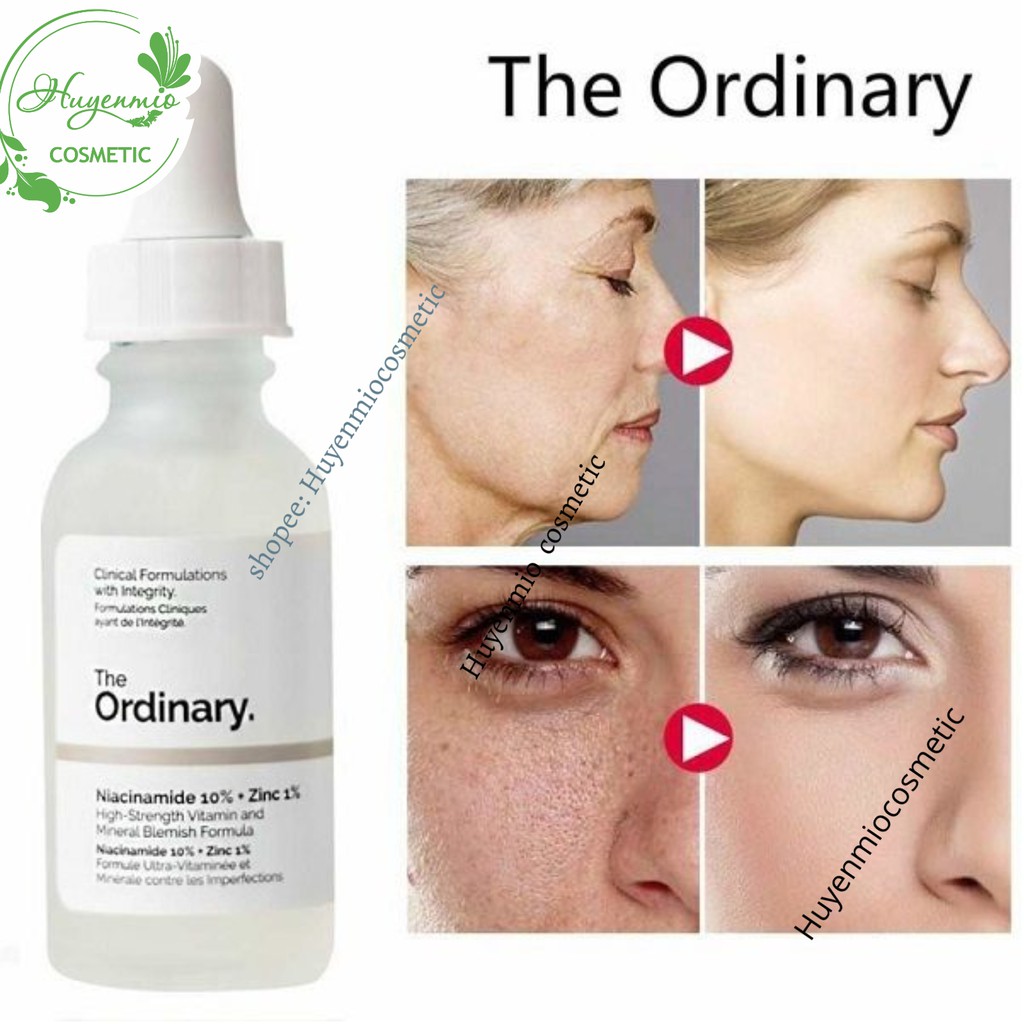 The Ordinary Niacinamide 10% + Zinc 1% Tinh chất giảm mụn thâm - 30ml [CHÍNH HÃNG]