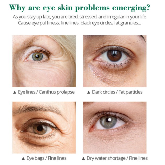 Tinh Chất làm trắng da da, dưỡng da mặt, giảm nhăn vùng mắt 30ml | BigBuy360 - bigbuy360.vn