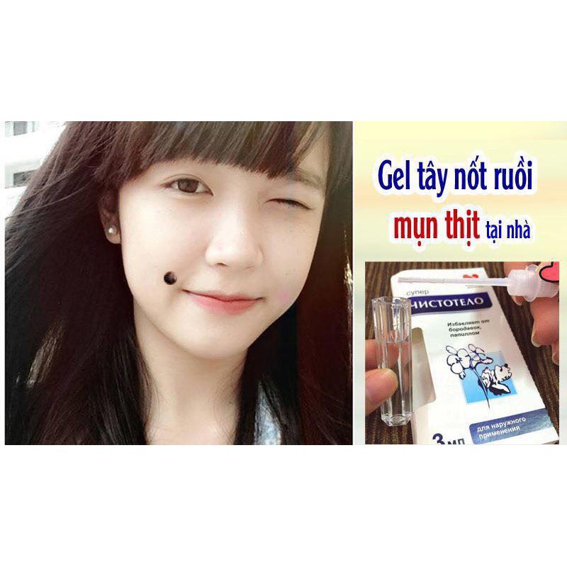 Dung dịch diệt mụn cơm, mụn cóc, sạn cá, mụn thịt của nga, sẵn hàng | BigBuy360 - bigbuy360.vn