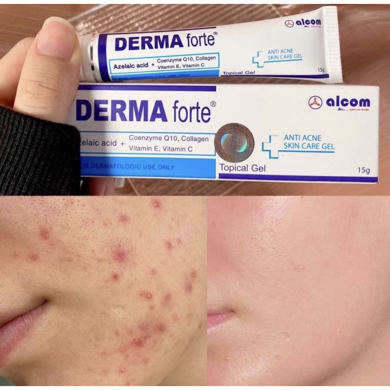 Derma Forted Gel 15G - Giảm mụn, ngừa thâm, sáng da