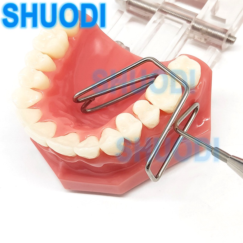 Dụng Cụ Tách Đôi Môi Bằng Thép Không Gỉ