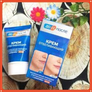 Kem trị nám và tàn nhang KpeM nga