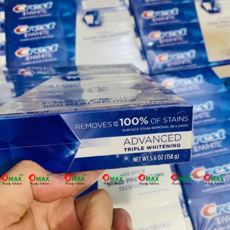 KEM ĐÁNH RĂNG CREST MỸ 158G - RĂNG CHẮC KHỎE - TRẮNG SÁNG - GIẢM NƯỚU VÀ HÔI MIỆNG