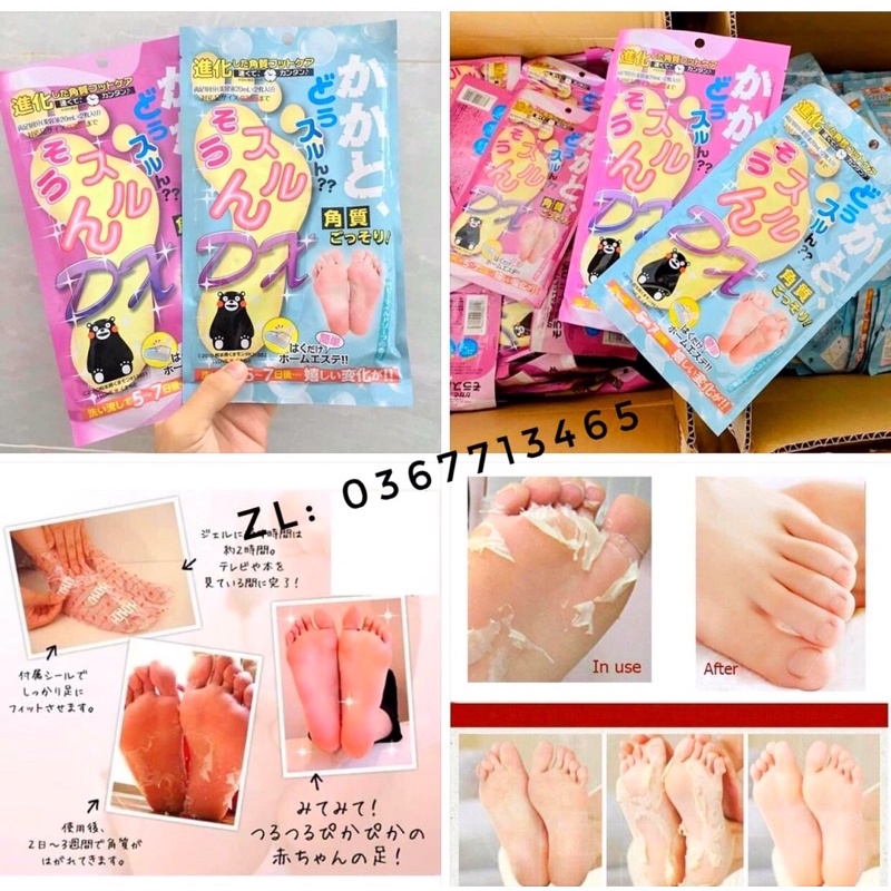 Túi Ủ Bong Da Chết Bàn Chân Mino Baby Foot Nhật Bản