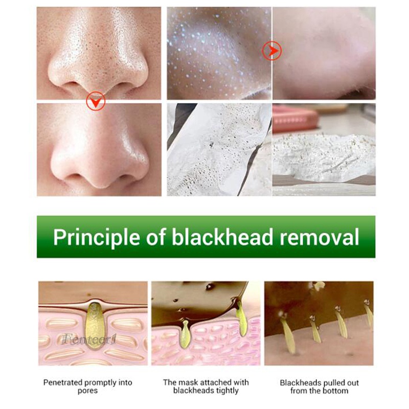 [Hàng mới về] Set 160 miếng dán lột mụn đầu đen làm sạch lỗ chân lông không chứa dầu