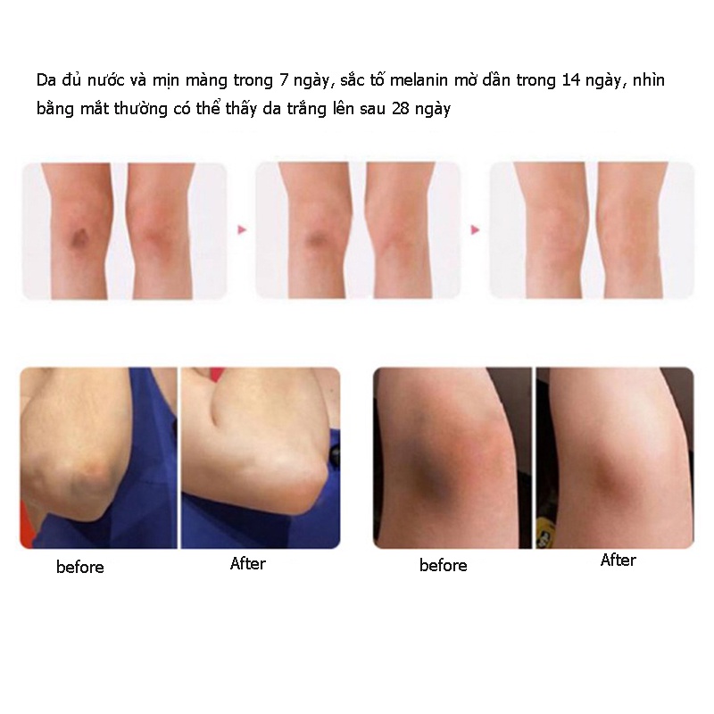 MAPUTI  Lotion Dưỡng Trắng Hồng Vùng Da Dưới Cánh Tay Và Vùng Da Dưới Cánh Tay Dung Tích 100ml