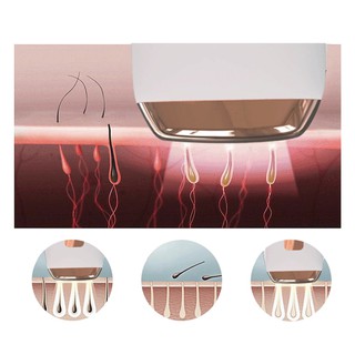 máy triệt lông vĩnh viễn cầm tay