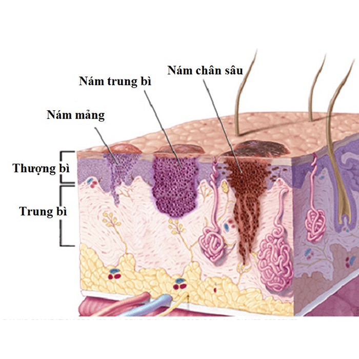 Combo 2 kem xóa mờ nám và dưỡng trắng da White Shinno Nhật Bản