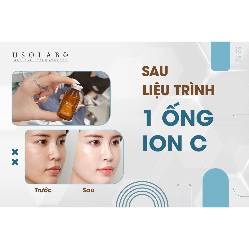 Điện di trắng da, mờ nám tại nhà Vita Ion C Usolab Korea | BigBuy360 - bigbuy360.vn