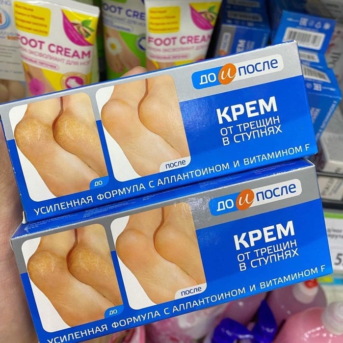 Kem Nứt Gót Chân Kpem Apteka Nga