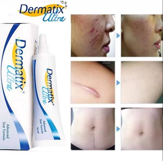 Gel hỗ trợ sẹo Dermatix Ultra 7g