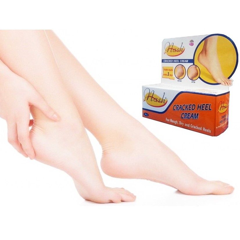 Kem Dưỡng Da Dùng Cho Gót Bàn Chân, Giúp Ngăn Ngừa Nứt Da Gót Chân Nash Cracked Heel Cream 25ml