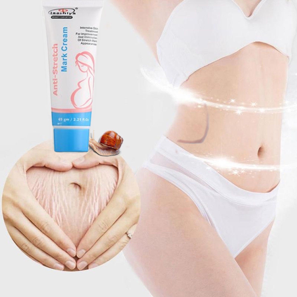 [ HCM]QIANSOTO Kem Làm Mờ Rạn Da Giảm Rạn Da vung Bụng Đùi sau sinh  Dưỡng da mềm mịn da bodycare hot